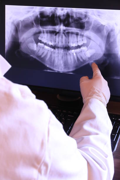 Best Knocked-Out Tooth Emergency  in Monongah, WV